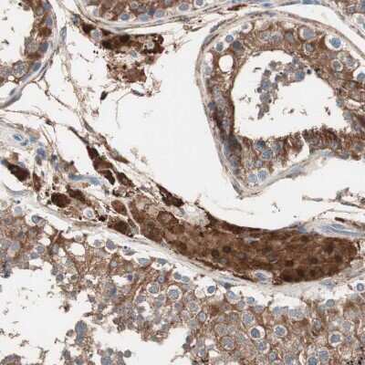 Immunohistochemistry-Paraffin: RAD54B Antibody [NBP1-83417]