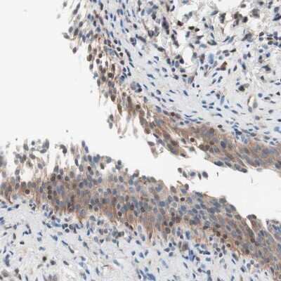 Immunohistochemistry-Paraffin: RAD54B Antibody [NBP1-83417]