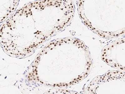 Immunohistochemistry-Paraffin: RAD54B Antibody [NBP2-99021]