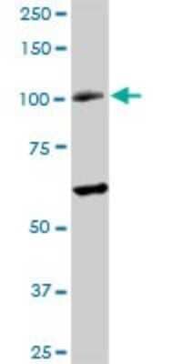 Western Blot: RAD54B Antibody [H00025788-D01P]