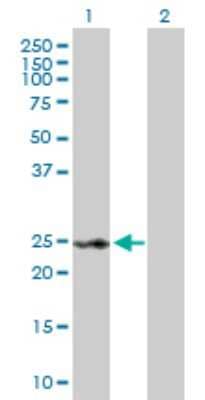 Western Blot: RAD54B Antibody [H00025788-D01P]