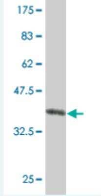 Western Blot: RAD54L Antibody (4G2) [H00008438-M01]