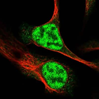 Immunocytochemistry/ Immunofluorescence: RAD54L Antibody [NBP2-33916]