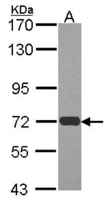 Western Blot: RAD54L Antibody [NBP1-31892]