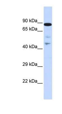 Western Blot: RAD54L Antibody [NBP1-58228]