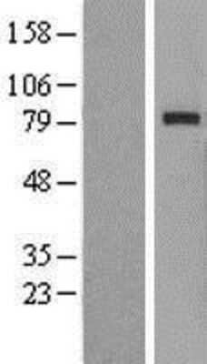 Western Blot: RAD54L Overexpression Lysate [NBP2-09658]