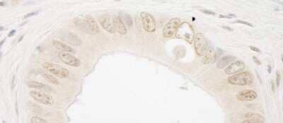 Immunohistochemistry-Paraffin: RAD54L2 Antibody [NBP1-19107]
