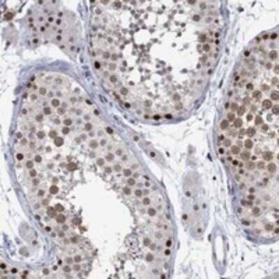 Immunohistochemistry-Paraffin: RAD54L2 Antibody [NBP3-17301]