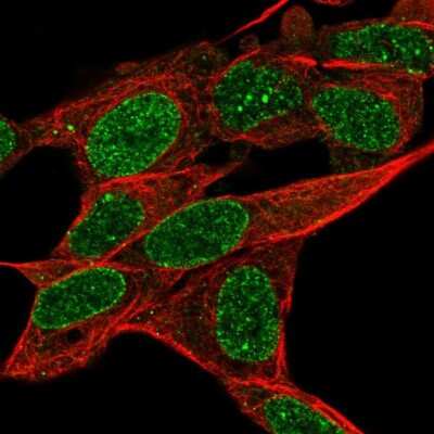 Immunocytochemistry/ Immunofluorescence: RADIL Antibody [NBP2-49021]