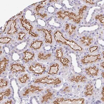 Immunohistochemistry-Paraffin: RADIL Antibody [NBP2-49021]