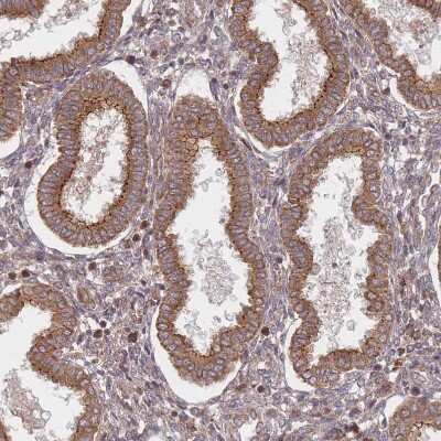 Immunohistochemistry-Paraffin: RADX Antibody [NBP1-83873]