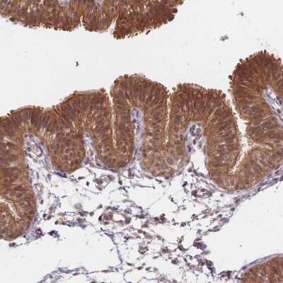 Immunohistochemistry-Paraffin: RADX Antibody [NBP1-83873]