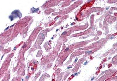 Immunohistochemistry-Paraffin: RAE1 Antibody [NB100-1894]