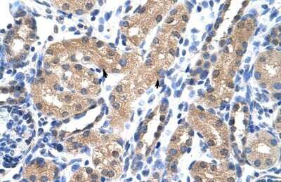 Immunohistochemistry-Paraffin: RAE1 Antibody [NBP1-57187]