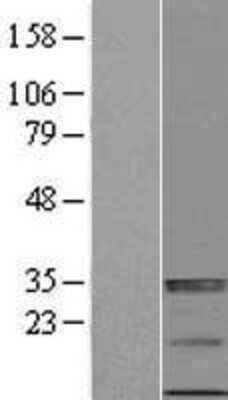 Western Blot: ULBP-4/RAET1E Overexpression Lysate [NBP2-05589]