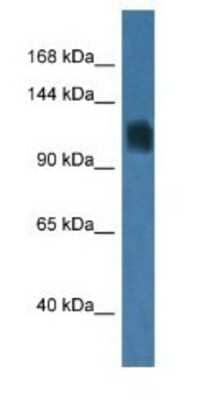 Western Blot: RAG1 Antibody [NBP1-74190]