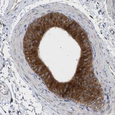 Immunohistochemistry-Paraffin: RAG1AP1 Antibody [NBP1-92311]