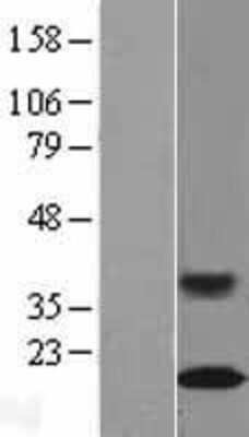 Western Blot: RAG1AP1 Overexpression Lysate [NBL1-15126]