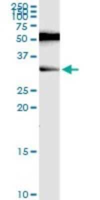 Western Blot: RAG2 Antibody (2G8) [H00005897-M06]