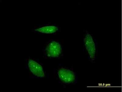 Immunocytochemistry/ Immunofluorescence: RAG2 Antibody [H00005897-B01P]