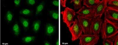 Immunocytochemistry/ Immunofluorescence: RAG2 Antibody [NBP2-43666]