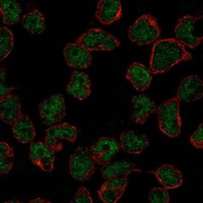 Immunocytochemistry/ Immunofluorescence: RAG2 Antibody [NBP2-68834]