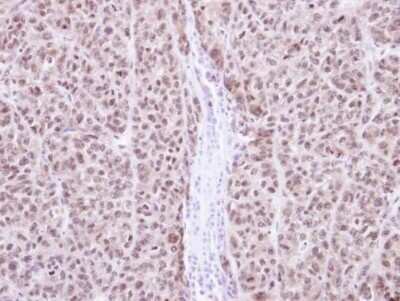 Immunohistochemistry-Paraffin: RAG2 Antibody [NBP2-43666]