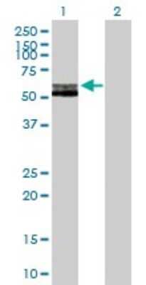 Western Blot: RAG2 Antibody [H00005897-B01P]