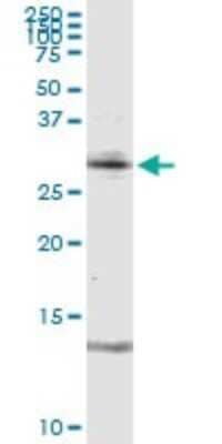 Western Blot: RAG2 Antibody [H00005897-D01P]