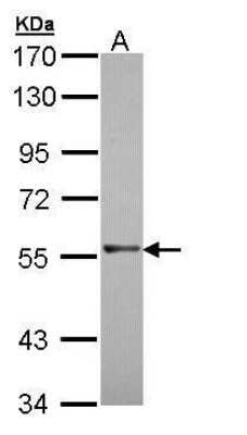 Western Blot: RAG2 Antibody [NBP2-43666]