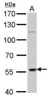 Western Blot: RAG2 Antibody [NBP2-43666]