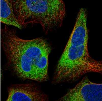 Immunocytochemistry/ Immunofluorescence: MOK Antibody [NBP1-81042]