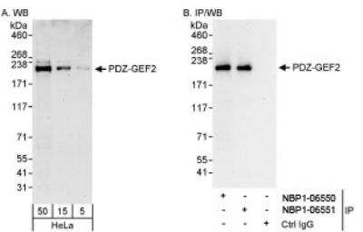 Western Blot: RAGEF2 Antibody [NBP1-06550]