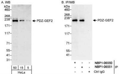 Western Blot: RAGEF2 Antibody [NBP1-06551]