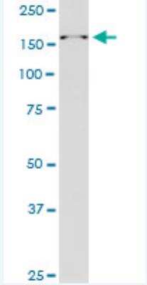 Western Blot: RAI1 Antibody (6H5) [H00010743-M01-100ug]