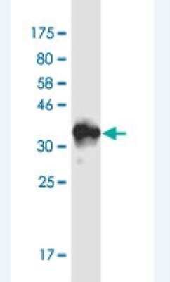 Western Blot: RAI1 Antibody (6H5) [H00010743-M01-100ug]