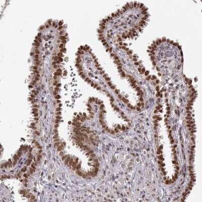 Immunohistochemistry-Paraffin: RAI1 Antibody [NBP2-58649]