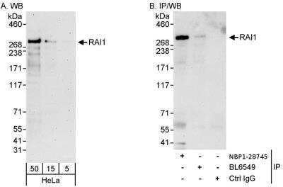 Immunoprecipitation: RAI1 Antibody [NBP1-28745]