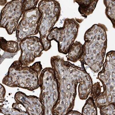 Immunohistochemistry-Paraffin: RAI14 Antibody [NBP1-94075]