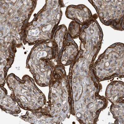 Immunohistochemistry-Paraffin: RAI14 Antibody [NBP1-94076]