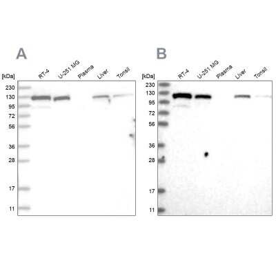 Western Blot: RAI14 Antibody [NBP1-94076]