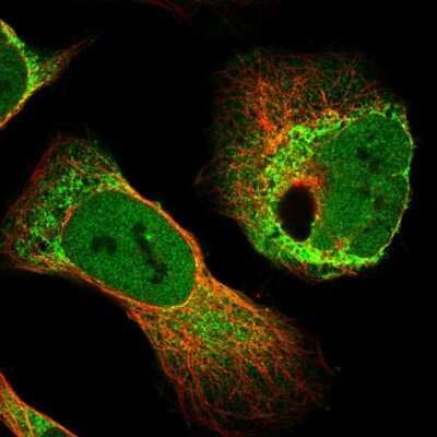 Immunocytochemistry/ Immunofluorescence: RAI16 Antibody [NBP1-92313]