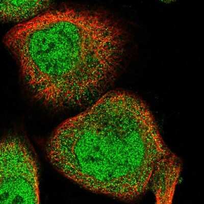 Immunocytochemistry/ Immunofluorescence: RAI16 Antibody [NBP1-92313]