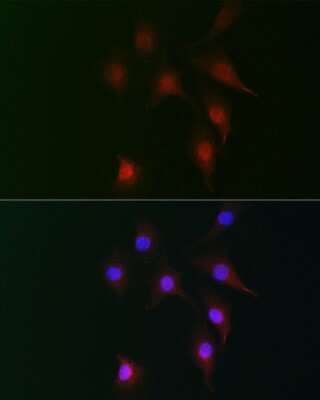 Immunocytochemistry/ Immunofluorescence: RAI16 Antibody - Azide and BSA Free [NBP3-15604]