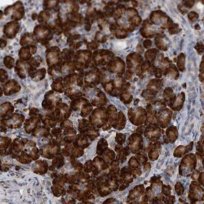 Immunohistochemistry-Paraffin: RAI16 Antibody [NBP1-92313]