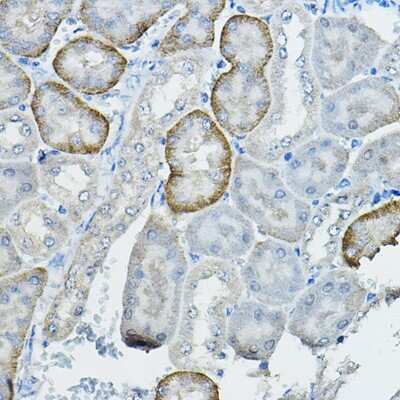 Immunohistochemistry-Paraffin: RAI16 Antibody - Azide and BSA Free [NBP3-15604]