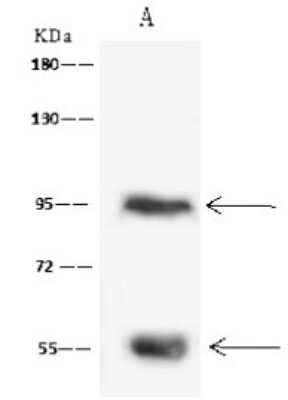 Immunoprecipitation: RAI16 Antibody [NBP2-97743]