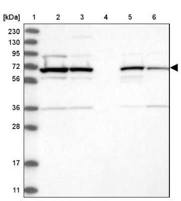 Western Blot: RAI16 Antibody [NBP1-92313]
