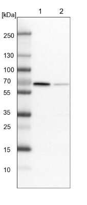 Western Blot: RAI16 Antibody [NBP1-92313]