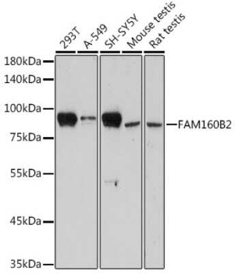 Western Blot: RAI16 AntibodyAzide and BSA Free [NBP3-15603]